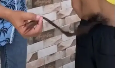נער עם זנב שעיר באורך 70 ס"מ: "אני לא מתבייש בו יותר"