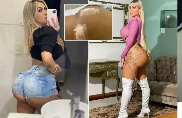 השקיעה 200 אלף שקלים כדי להשיג את הישבן הגדול בעולם - וזה נגמר באסון