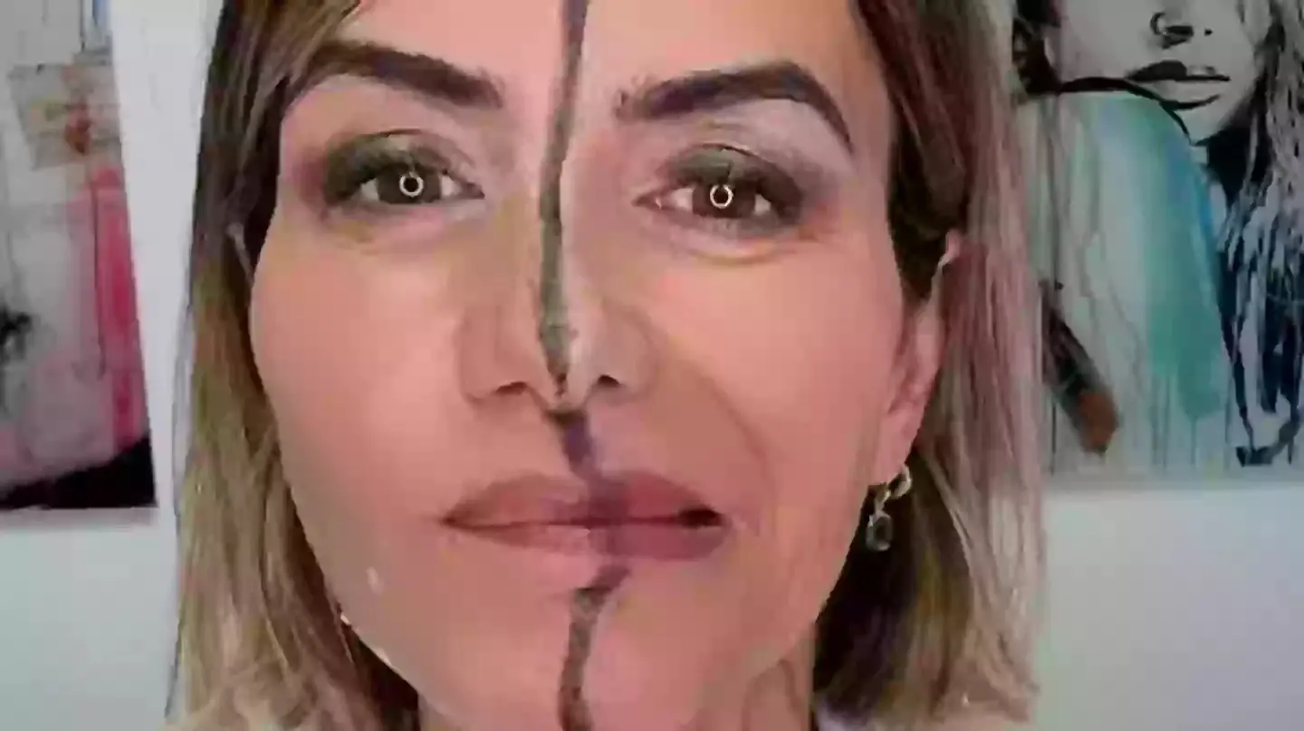 רופאה הזריקה בוטוקס לחצי מפניה כדי להראות בדיוק מה זה עושה