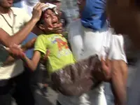 ניעלין: בן 12 נפצע בראשו מכדורי גומי