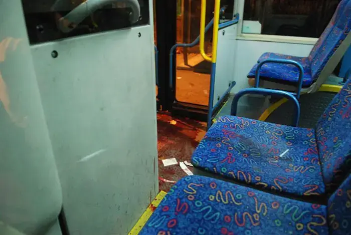 חשד: בת 20 נדקרה על ידי בן זוגה, מצבה קשה
