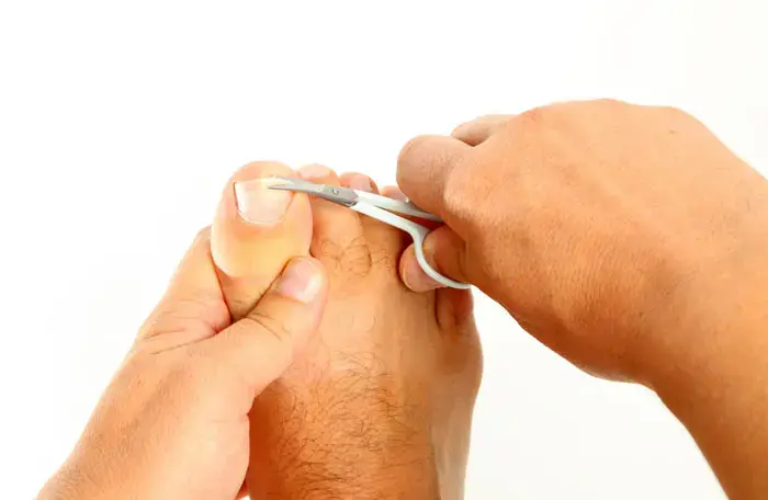מדענים: ציפורניים יכולות לנבא סיכון לסרטן
