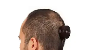 וואפה בילאל והמצלמה שהושתלה בראשו מתוך הטמבלר deaddutchpainters (צילום מסך)