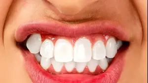 חריקת שיניים (ShutterStock)