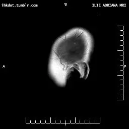 גיף מוח (Giphy)