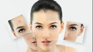 טיפול בעור הפנים (ShutterStock)