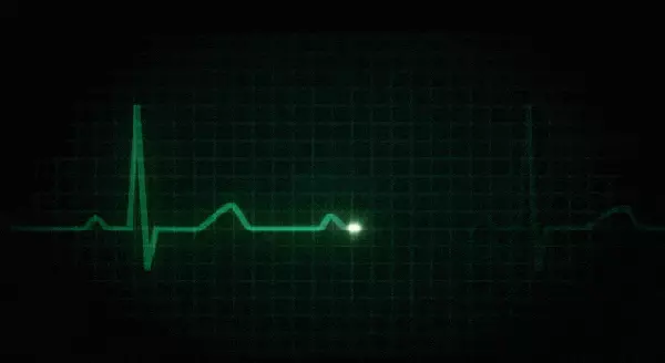 גיף מוניטור רפואי (Giphy)