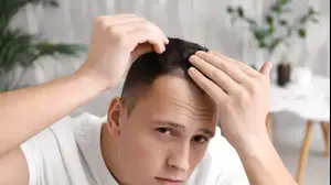 איילת גייר התקרחות גברית (ShutterStock)