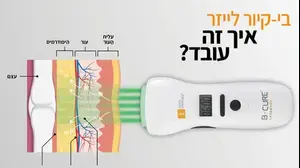 בי קיור לייזר - איך זה עובד? ( , בי קיור לייזר)