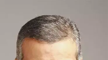 משה טרי יור הרשות לניירות ערך משה טרי יור הרשות לניירות ערך