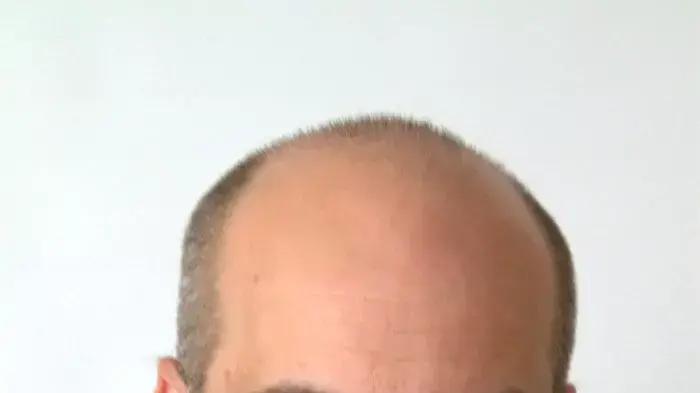 אבי מלכה אבי מלכה