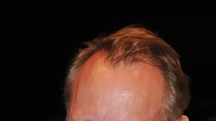 "פון טרייר נאצי? תבינו אירוניה, אנשים". סטלן סקרסגרד, מכוכבי "מלנכוליה" "פון טרייר נאצי? תבינו אירוניה, אנשים". סטלן סקרסגרד, מכוכבי "מלנכוליה"