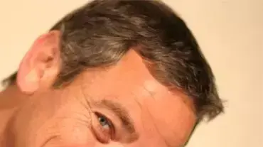 עדי ברקן עדי ברקן