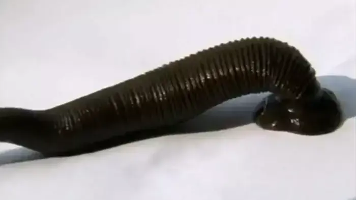 עלוקה שהוצאה בגרונו של נער סיני עלוקה שהוצאה בגרונו של נער סיני