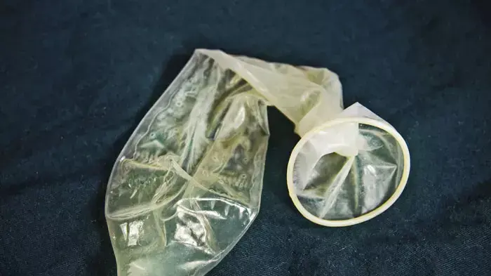 קונדום קונדום