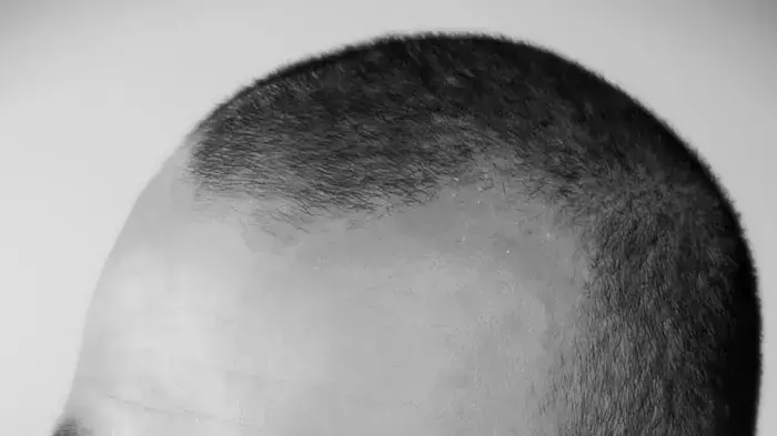 עושה חיל. אפללו עושה חיל. אפללו