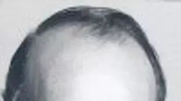 פיטר האנסון, ראש אונרא בשטחים (צילום: אתר האום)