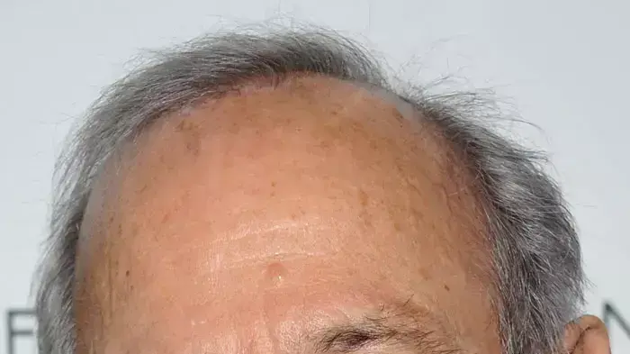קריירה ארוכה ומרשימה. גזארה קריירה ארוכה ומרשימה. גזארה