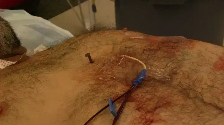 מסמר נעוץ בליבו של אמריקני מסמר נעוץ בליבו של אמריקני