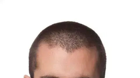 רן לבנה, אוגוסט 2012 רן לבנה, אוגוסט 2012