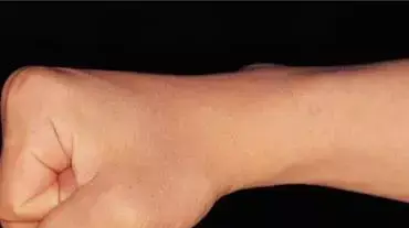 אילוסטרציה אגרוף אלימות אילוסטרציה אגרוף אלימות