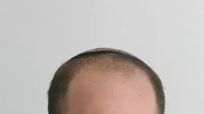 אנשל פפר צו פיוס אנשל פפר צו פיוס