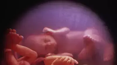 תאומים ברחם עם לוגו פייסבוק תאומים ברחם עם לוגו פייסבוק