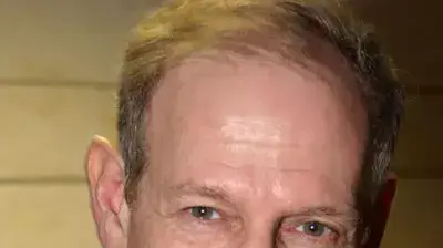 אילן שלגי אילן שלגי