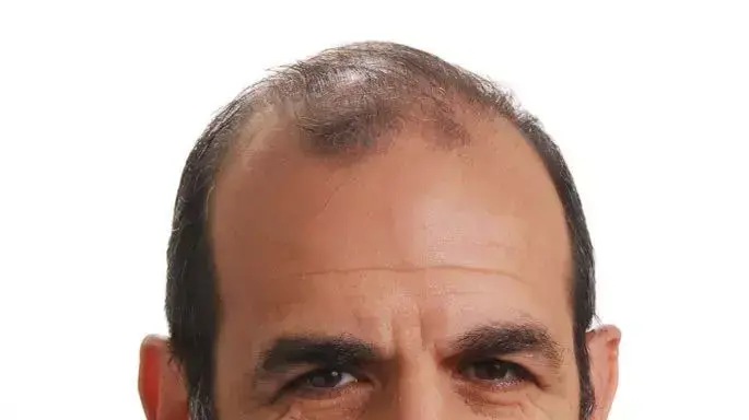 עו"ד גלעד שר, יו"ר משותף של תנועת "עתיד כחול לבן" וחוקר בכיר במכון למחקרי ביטחון לאומי INSS, לשעבר מנהל לשכת ראש הממשלה ומראשי צוות המו"מ המדיני עו"ד גלעד שר, יו"ר משותף של תנועת "עתיד כחול לבן" וחוקר בכיר במכון למחקרי ביטחון לאומי INSS, לשעבר מנהל לשכת ראש הממשלה ומראשי צוות המו"מ המדיני