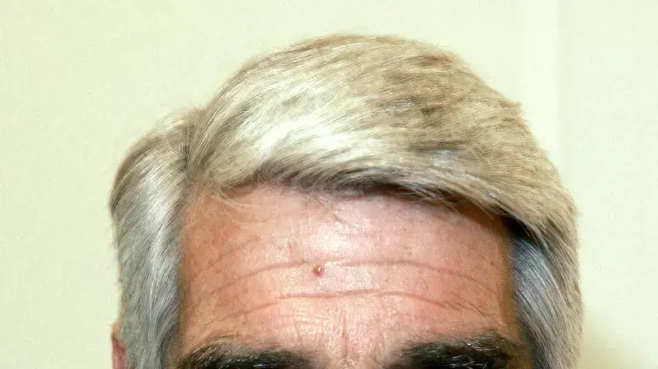 הארי רימס הארי רימס
