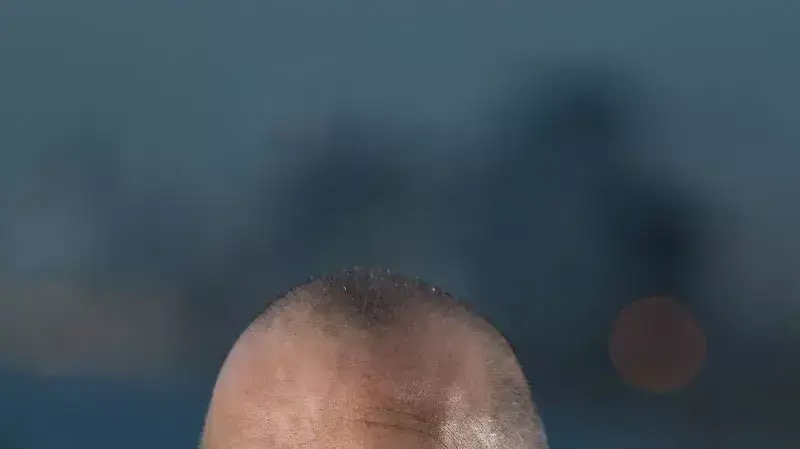 יובל דיסקין, ראש השב"כ לשעבר