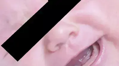 תינוק אילוסטרציה תינוק אילוסטרציה