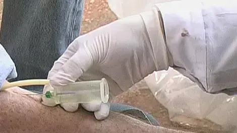 בדיקת אידס בדיקת אידס