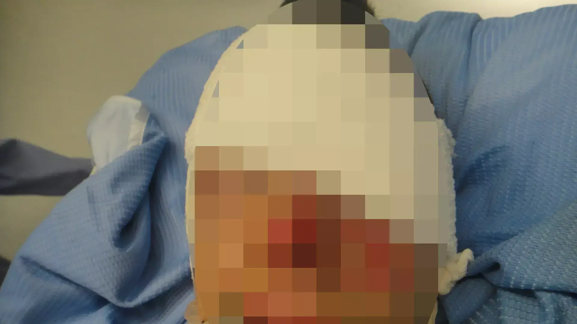 נער הגיע למיון ואיבד את מאור עיניו בעקבות משחק בנפצים. פברואר 2014 נער הגיע למיון ואיבד את מאור עיניו בעקבות משחק בנפצים. פברואר 2014