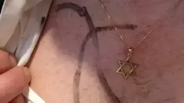 יהודי צרפתי בן 59 הותקף על ידי אנטישמי בפריז, מרץ 2014 יהודי צרפתי בן 59 הותקף על ידי אנטישמי בפריז, מרץ 2014