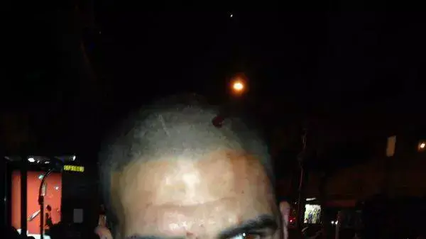 משה טוויטו שהותקף לכאורה על ידי מאבטחים במועדון "ווליום" בתל אביב, אפריל 2014 משה טוויטו שהותקף לכאורה על ידי מאבטחים במועדון "ווליום" בתל אביב, אפריל 2014