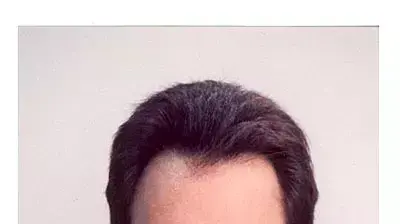 צינתור גונסון את גונסון צינתור גונסון את גונסון