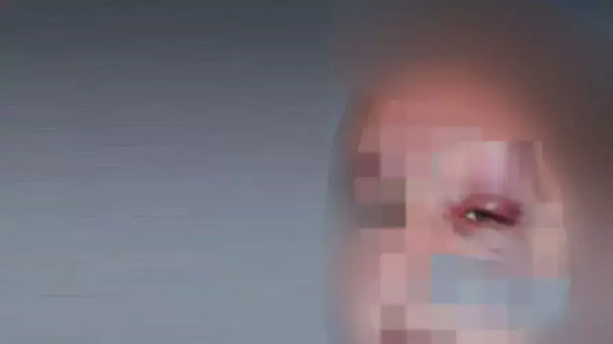הותקף לאחר שנגנב לו המצית הותקף לאחר שנגנב לו המצית