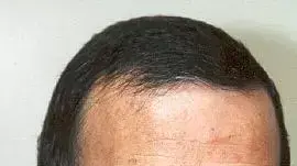 רוני ארן סמנכל השיווק של ערוץ 10 רוני ארן סמנכל השיווק של ערוץ 10