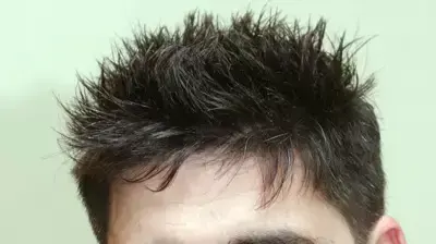 רון לוינטל שינוי רון לוינטל שינוי