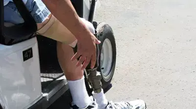 רגל תותבת רגל תותבת