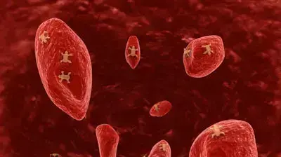 cancer cells תאי סרטן cancer cells תאי סרטן