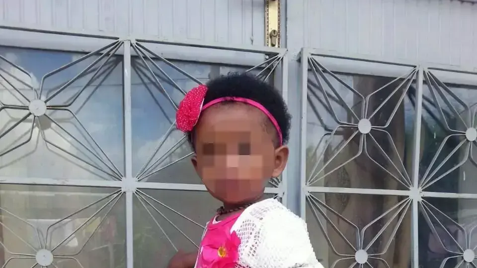 ילדה אתיופית שנולדה עם שפה שסועה נותחה בבית החולים רמב"ם. מרץ 2016