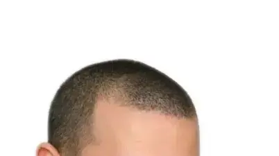 רותם דנון רותם דנון