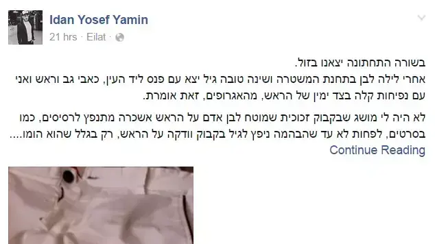 עידן יוסף ימין, שהותקף על רקע הומופובי בעיר אילת ב-30 באפריל 2016, סיפר בפייסבוק על המקרה והציג את מכנסיו המוכתמים בדם עידן יוסף ימין, שהותקף על רקע הומופובי בעיר אילת ב-30 באפריל 2016, סיפר בפייסבוק על המקרה והציג את מכנסיו המוכתמים בדם