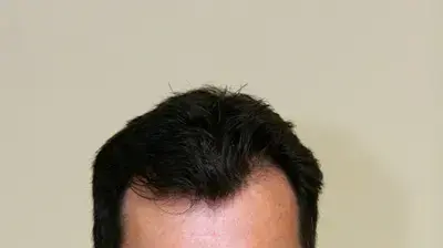 יורם מוקדי יורם מוקדי