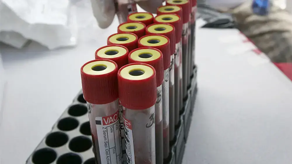מבחנות דם נשלחות לבדיקות HIV. הונדורס, דצמבר 2009 מבחנות דם נשלחות לבדיקות HIV. הונדורס, דצמבר 2009