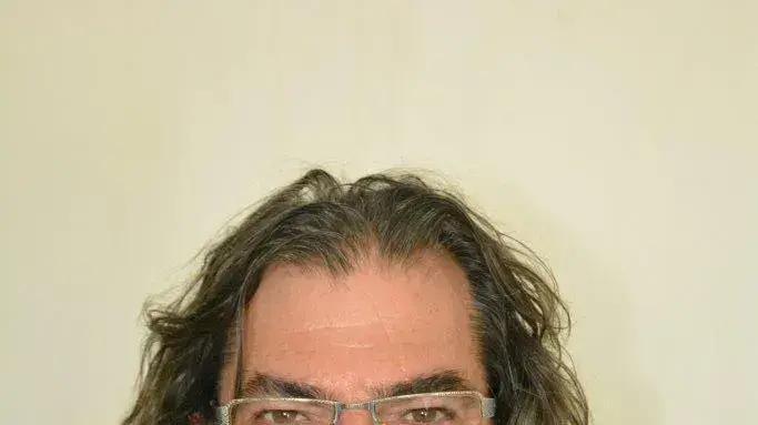 מוש דנון בתגובה: "ביצה מגעילה. אתה בא לעשות טוב ופוליטרוקים קטנים עם מניעים אישיים מחבלים בהכל" מוש דנון בתגובה: "ביצה מגעילה. אתה בא לעשות טוב ופוליטרוקים קטנים עם מניעים אישיים מחבלים בהכל"