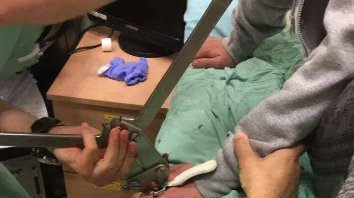 החבלה בעקבות תאונת הספינר 10 במאי 2017 החבלה בעקבות תאונת הספינר 10 במאי 2017