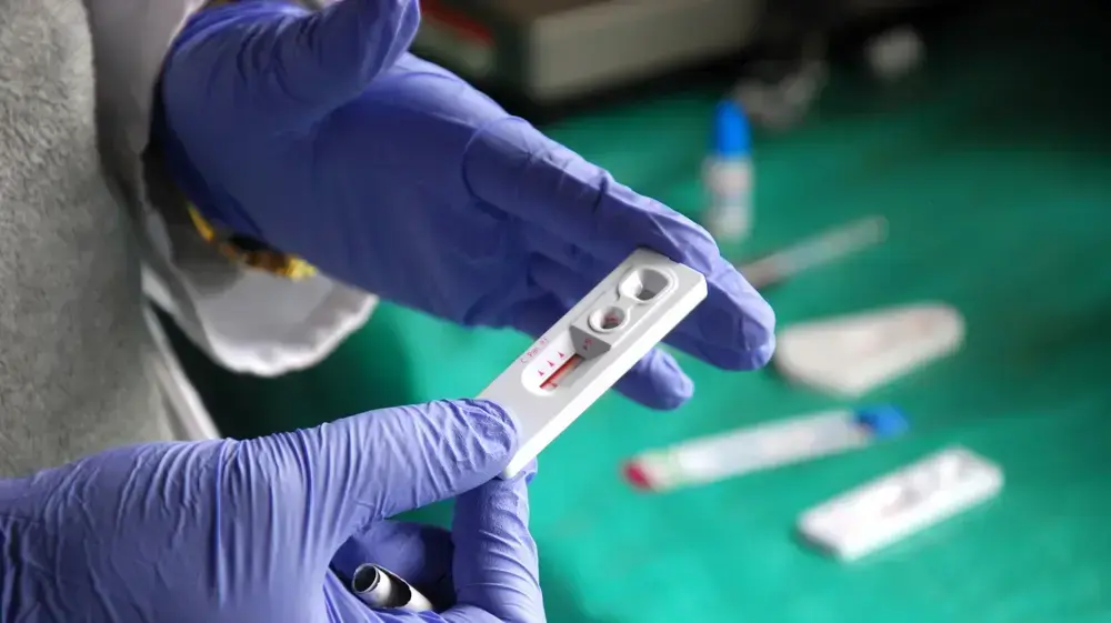 בדיקת HIV בדיקת HIV